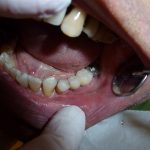 The Importance Of Regular Checkups At Spilsby Dentist Surgery