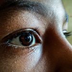 Graves Eye Disease: Understanding the Causes and Symptoms
